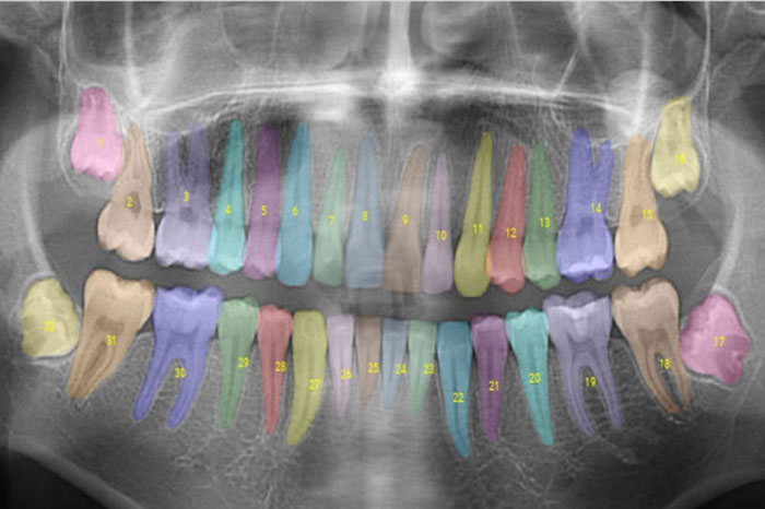 a colorized and coded X-ray of human teeth
