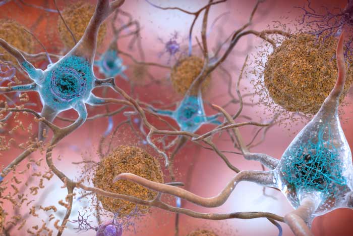 neurons